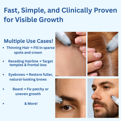 Solavo Hair Growth Roller